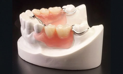 Partial removable Denture